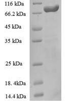 Escherichia coli Anaerobic ribonucleoside-triphosphate reductase (nrdD) Recombinant Protein - BioCrest Sci