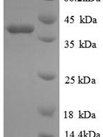 Human Glutaredoxin-1 (GLRX) Recombinant Protein - BioCrest Sci