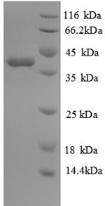 Human Glutaredoxin-1 (GLRX) Recombinant Protein, Homo sapiens (Human), E.coli, N-terminal GST-tagged, 38.8 kDa, purity >≥ 90% as determined by SDS-PAGE.