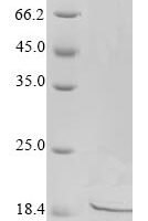 Human Disco-interacting protein 2 homolog A (DIP2A), partial Recombinant Protein - BioCrest Sci