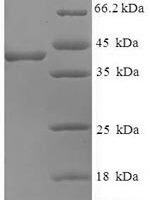 Human Peptidyl-prolyl cis-trans isomerase FKBP3 (FKBP3) Recombinant Protein - BioCrest Sci