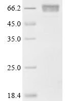 Mouse Uncharacterized protein C1orf54 homolog Recombinant Protein, C-hFc1 - BioCrest Sci