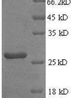 Rat Fibroblast growth factor 23 (Fgf23) Recombinant Protein, N-His, aa 25–251, E.coli - BioCrest Sci