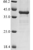 Human Interleukin-17A (IL17A), partial Recombinant Protein - BioCrest Sci