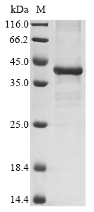 Human Interleukin-17A (IL17A), partial Recombinant Protein, Homo sapiens (Human), E.coli, N-terminal 6xHis-GST-tagged, 44.0 kDa, purity >≥ 85% as determined by SDS-PAGE.