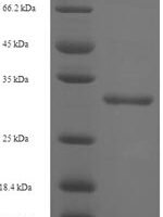 Human CMP-N-acetylneuraminate-poly-alpha-2,8-sialyltransferase (ST8SIA4) Recombinant Protein - BioCrest Sci