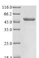 Human Gasdermin-B (GSDMB) Recombinant Protein - BioCrest Sci