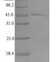 Human Mitochondrial import inner membrane translocase subunit Tim17-B (TIMM17B) Recombinant Protein - BioCrest Sci