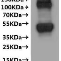 Human Large neutral amino acids transporter small subunit 1 (SLC7A5)-VLPs Recombinant Protein - BioCrest Sci