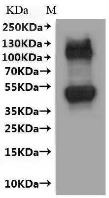 Human Large neutral amino acids transporter small subunit 1 (SLC7A5)-VLPs Recombinant Protein, Homo sapiens (Human), Mammalian cell, C-terminal 10xHis-tagged, 56.4 kDa, purity >≥ 90% as determined by SEC-HPLC.
