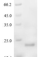 Mouse Serglycin (Srgn) Recombinant Protein - BioCrest Sci