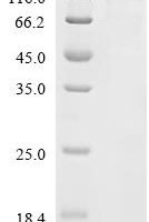 Human Thyrotropin receptor (TSHR), partial Recombinant Protein, C-hFc1, aa 21–413 - BioCrest Sci