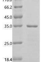 Komagataella pastoris DSMZ 70382 CEA1 Recombinant Protein, N-His, aa 1–220, E.coli - BioCrest Sci