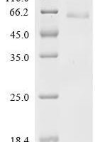 Human CUB domain-containing protein 1 (CDCP1), partial Recombinant Protein - BioCrest Sci
