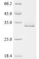 Human YTH domain-containing family protein 2 (YTHDF2), partial Recombinant Protein, C-His, aa 390–579 - BioCrest Sci