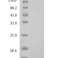 Human Corticotropin-releasing factor receptor 1 (CRHR1), partial Recombinant Protein, N-His - BioCrest Sci