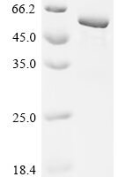 Human Methyltransferase-like protein 17, mitochondrial (METTL17) Recombinant Protein, N-His - BioCrest Sci