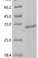 Human Coagulation factor VIII (F8) Recombinant Protein, C-His - BioCrest Sci