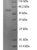 Human Chromogranin-A (CHGA), partial Recombinant Protein, N-GST - BioCrest Sci