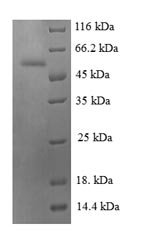 Human Chromogranin-A (CHGA), partial Recombinant Protein, N-GST, Homo sapiens (Human), E.coli, N-terminal GST-tagged, 53.4 kDa, purity >≥ 90% as determined by SDS-PAGE.