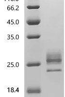 Mouse Interleukin-1 beta (Il1b), Biotinylated Recombinant Protein - BioCrest Sci