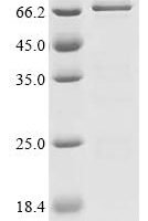Xenopus laevis Bic-C protein (Bic-C) (D166A), partial Recombinant Protein - BioCrest Sci