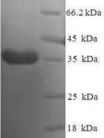 Human DPY30 domain-containing protein 2 (DYDC2) Recombinant Protein - BioCrest Sci