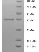 Human Tumor protein D52 (TPD52) Recombinant Protein - BioCrest Sci