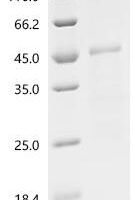 Murine coronavirus Spike glycoprotein (S), partial Recombinant Protein - BioCrest Sci
