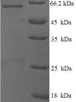 Mouse Cellular tumor antigen p53 (Tp53), partial Recombinant Protein - BioCrest Sci