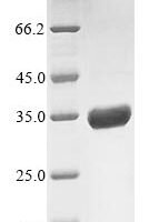 Rotavirus A Outer capsid protein VP4, partial Recombinant Protein, N-10His/C-Myc, aa 248–480 - BioCrest Sci