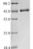 Human Poly (rC)-binding protein 2 (PCBP2) Recombinant Protein - BioCrest Sci