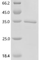 Human Cholesteryl ester transfer protein (CETP), partial Recombinant Protein - BioCrest Sci
