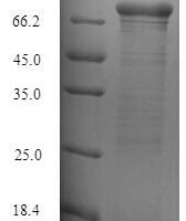 Staphylococcus aureus Clumping factor B (clfB), partial Recombinant Protein - BioCrest Sci