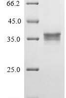 Human Urocortin-2 (UCN2), partial Recombinant Protein - BioCrest Sci