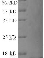 Human Matrix Gla protein (MGP) Recombinant Protein, N-His - BioCrest Sci