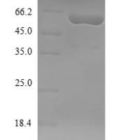 Clostridium botulinum Botulinum neurotoxin type F (botF), partial Recombinant Protein - BioCrest Sci