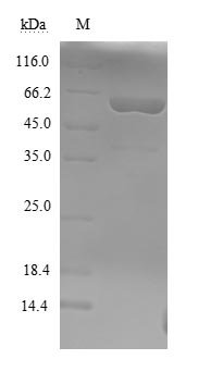 Clostridium botulinum Botulinum neurotoxin type F (botF), partial Recombinant Protein, Clostridium botulinum, Yeast, N-terminal 6xHis-tagged, 51.6 kDa, purity >≥ 90% as determined by SDS-PAGE.