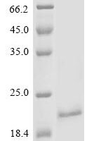 Mouse Alpha-2-macroglobulin receptor-associated protein (Lrpap1), partial Recombinant Protein, N-10His/C-Myc, aa 248–360 (H294F,H296F,Y297C,H305F) - BioCrest Sci