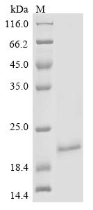 Mouse Alpha-2-macroglobulin receptor-associated protein (Lrpap1), partial Recombinant Protein, N-10His/C-Myc, aa 248–360 (H294F,H296F,Y297C,H305F), Mus musculus (Mouse), Baculovirus, N-terminal 10xHis-tagged and C-terminal Myc-tagged, 18.2 kDa, purity >≥ 85% as determined by SDS-PAGE.
