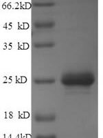 Pasteurella haemolytica Leukotoxin (lktA), partial Recombinant Protein - BioCrest Sci