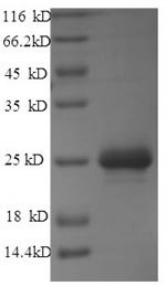 Pasteurella haemolytica Leukotoxin (lktA), partial Recombinant Protein, Mannheimia haemolytica (Pasteurella haemolytica), E.coli, N-terminal GST-tagged, 53.0 kDa, purity >≥ 90% as determined by SDS-PAGE.