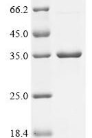 Escherichia coli Intermembrane phospholipid transport system lipoprotein MlaA (mlaA) Recombinant Protein - BioCrest Sci