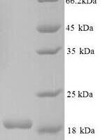 Human Connector enhancer of kinase suppressor of ras 2 (CNKSR2), partial Recombinant Protein - BioCrest Sci