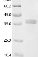 Mouse Nephrin (Nphs1), partial Recombinant Protein, C-His, aa 36–250, E.coli - BioCrest Sci