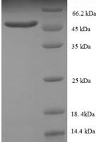 Human SWI/SNF-related matrix-associated actin-dependent regulator of chromatin subfamily B member 1 (SMARCB1), partial Recombinant Protein, N-His, aa 2–376, Baculovirus - BioCrest Sci