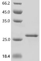 Mouse Zymogen granule membrane protein 16 (Zg16) Recombinant Protein - BioCrest Sci