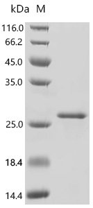Mouse Zymogen granule membrane protein 16 (Zg16) Recombinant Protein, Mus musculus (Mouse), E.coli, C-terminal 6xHis-tagged, 23.6 kDa, purity >≥ 90% as determined by SDS-PAGE.