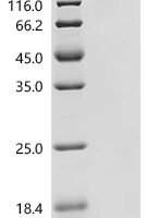 Human LIM domain kinase 1 (LIMK1) Recombinant Protein - BioCrest Sci