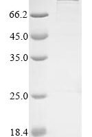 Human Cartilage intermediate layer protein 1 (CILP), partial Recombinant Protein, N-MBP/C-His - BioCrest Sci